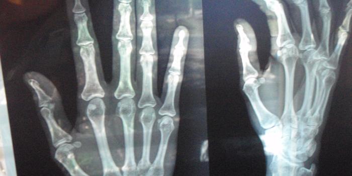 3072x2304 X Ray HD desktop wallpaper : Widescreen : High Definition : Fullscreen