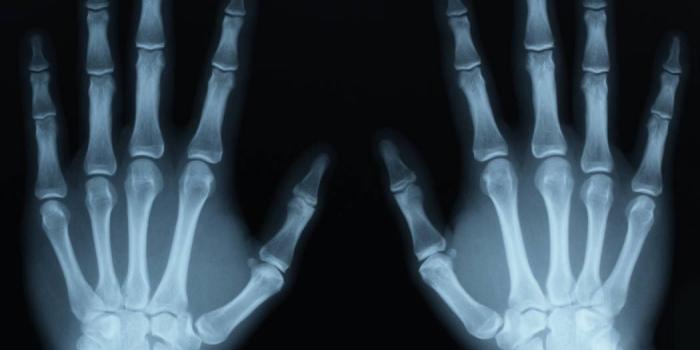 1050x750 X Ray Free Wallpaper & Backgrounds - Larutadelsorigens