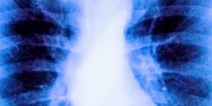 960x1280 Smokers X-ray day Wallpaper by Daddydavey - ae - Free on ZEDGE™