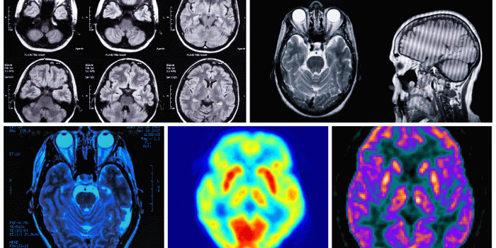 1366x768 Clinical Radiology, Radiography, Radiopharmaceuticals |Open Medscience