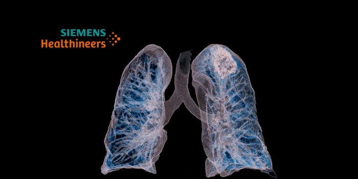 1600x900 Siemens Healthineers Debuts AI-Rad Companion Chest CT Based on New