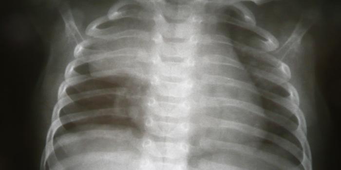 3072x2304 50+] Radiology Wallpaper on WallpaperSafari