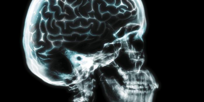 1823x1648 brain, Anatomy, Medical, Head, Skull, Digital, 3 d, X ray, Xray