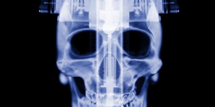 1024x768 X-ray Skull Wallpaper