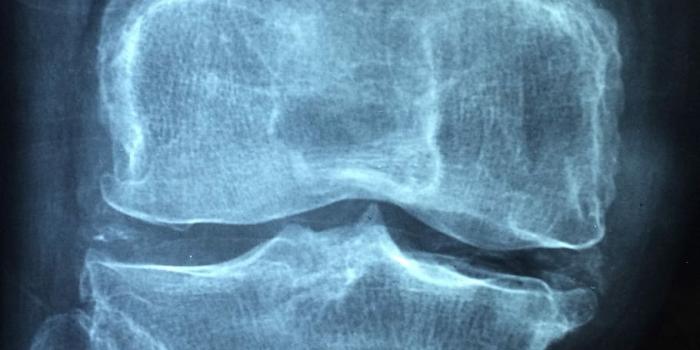 910x1213 HD wallpaper: X-ray results on bone, knee, old, care, injury, pain