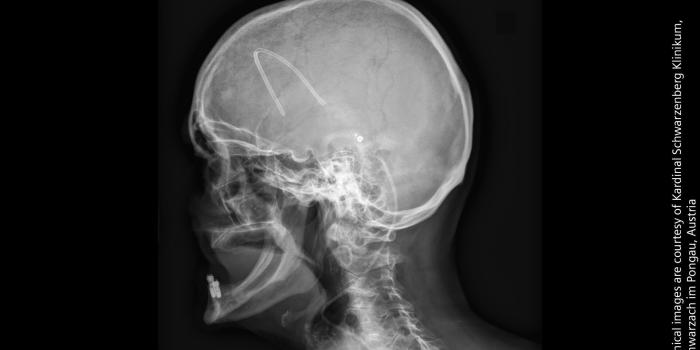 1920x1080 Multix Fusion Max | Built to perform in daily radiography - Siemens