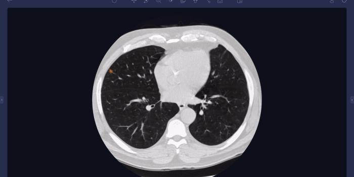 1440x900 Arterys Demonstrates AI Cloud-Based Medical Image Analysis Solutions