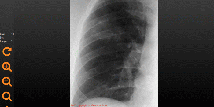 1024x768 Medical Imaging Software for Radiology Case Viewing | IDKD