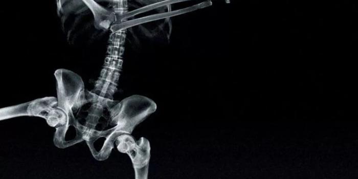 1080x1920 Skeleton iPhone Wallpapers (40+ images) - WallpaperBoat