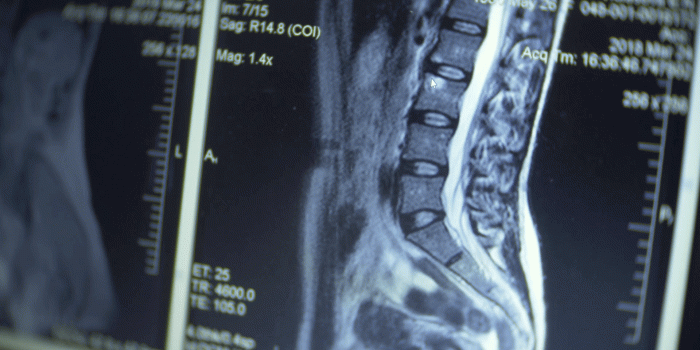 1920x1080 Close. MRI X-ray images. results of magneto resonance therapy on the  computer screen. 4k, blurring the frame boundaries. Stock Video Footage - 