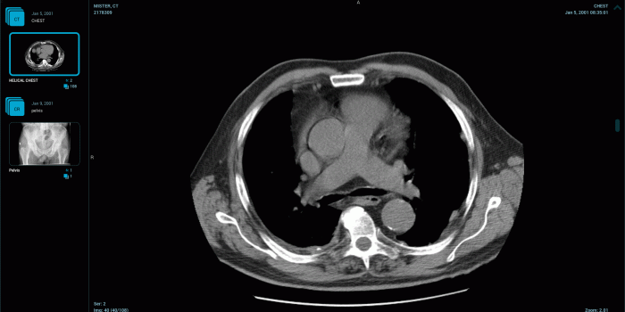 1920x1080 DICOM Viewer - Apps - App Store - Nextcloud