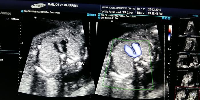 2048x1152 Artic Arch wallpaper