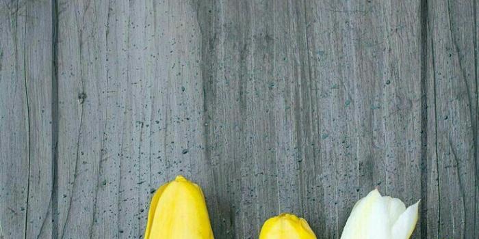 736x1308 Tulips wallpaper | Pretty iPhone Wallpaper in 2019 | Phone