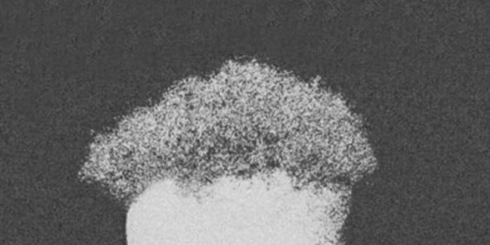 1079x1920 XXXTentacion Album Wallpapers