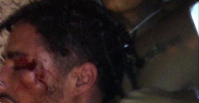 675x1200 The Story behind the cover of Yung Bratz : XXXTENTACION