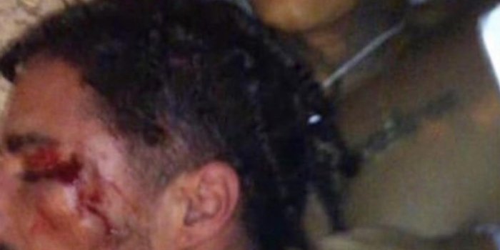 1242x2208 Wallpaper : XXXTENTACION