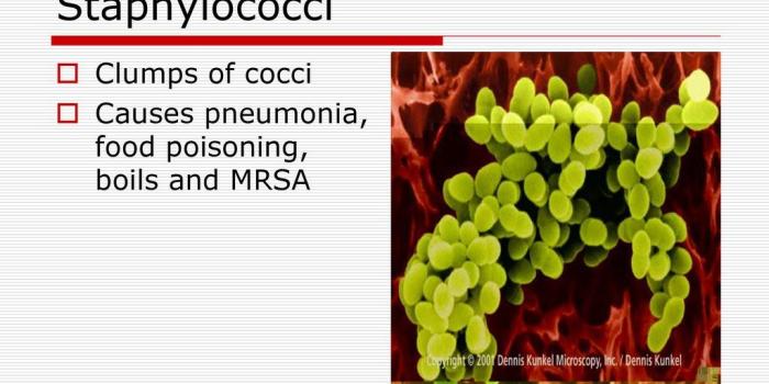 1024x768 The Immune system and health - ppt download