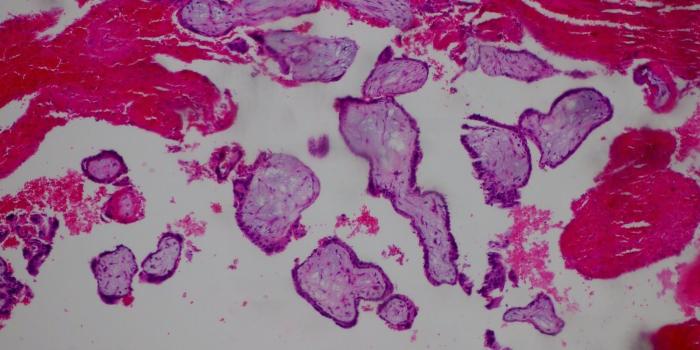 1600x1200 Journal of Postgraduate Gynecology & Obstetrics: July 2016