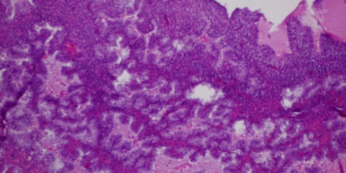 1600x1200 Journal of Postgraduate Gynecology & Obstetrics: July 2016