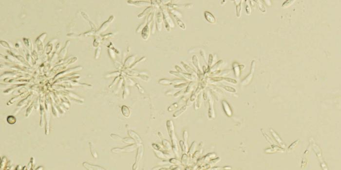 1360x1024 57 questions with answers in Phytopathogenic Fungi | Science topic